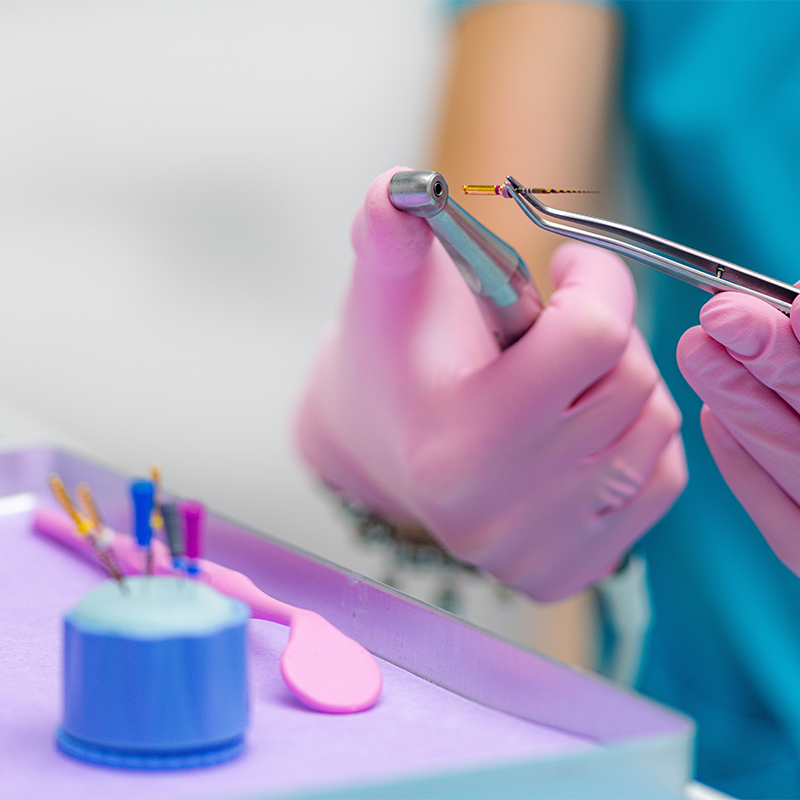 Root canal treatment illustration